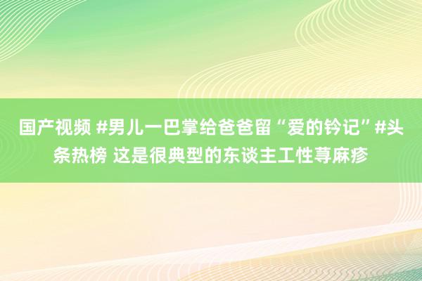 国产视频 #男儿一巴掌给爸爸留“爱的钤记”#头条热榜 这是很典型的东谈主工性荨麻疹