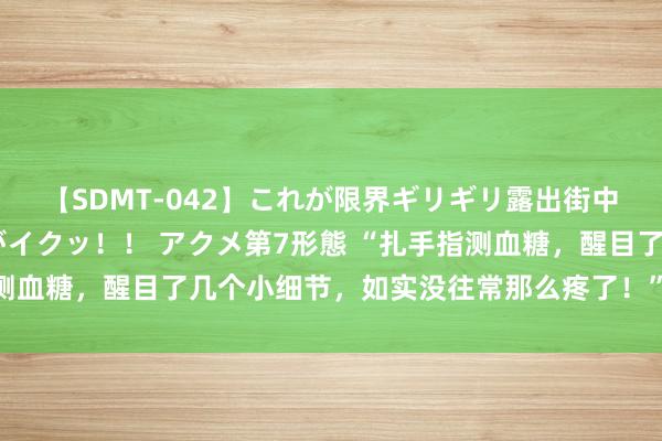 【SDMT-042】これが限界ギリギリ露出街中潮吹き アクメ自転車がイクッ！！ アクメ第7形態 “扎手指测血糖，醒目了几个小细节，如实没往常那么疼了！”。 在糖尿病